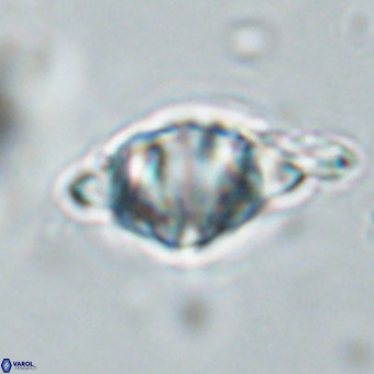 Discoaster musicus VR 19672