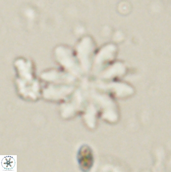 Discoaster mediosus 60847