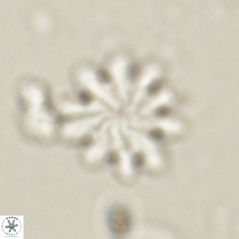 Discoaster mediosus 60848