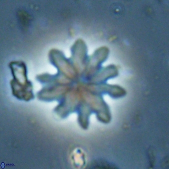 Discoaster mediosus 60849
