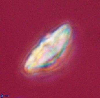 Discoaster misofengaro 23935