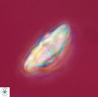 Discoaster misofengaro 23935