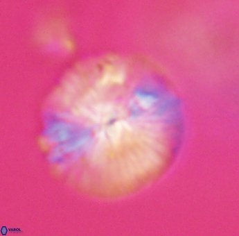 Discoaster misofengaro 23939