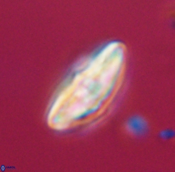 Discoaster misofengaro 23931