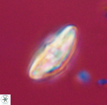 Discoaster misofengaro 23931