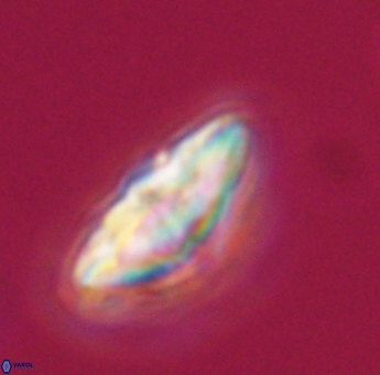 Discoaster misofengaro 23932