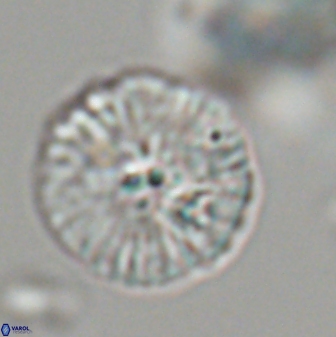 Discoaster misofengaro 23944