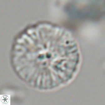 Discoaster misofengaro 23944