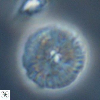 Discoaster misofengaro 23946