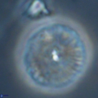 Discoaster misofengaro 23947