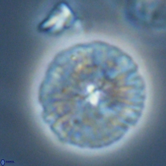 Discoaster misofengaro 23948