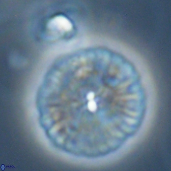 Discoaster misofengaro 23949