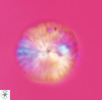 Discoaster misofengaro 23942