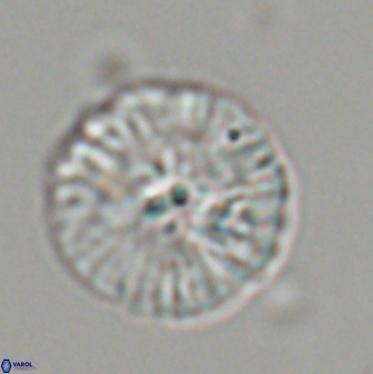 Discoaster misofengaro 23943