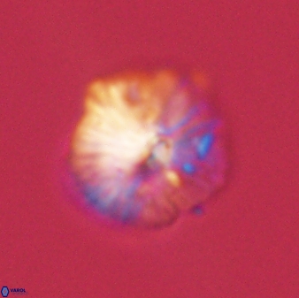 Discoaster misofengaro 57260