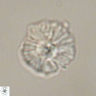 Discoaster misofengaro 57261