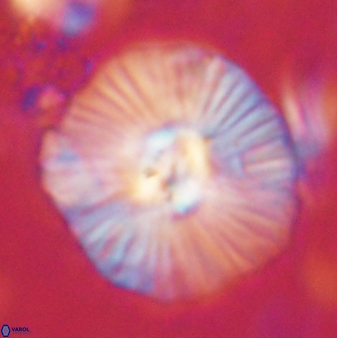 Discoaster misofengaro 60992