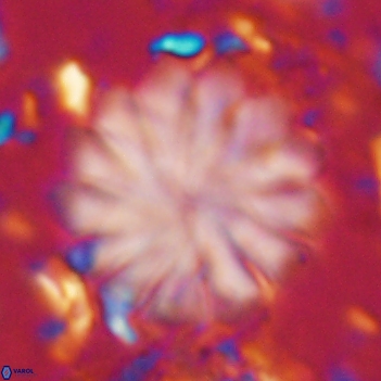 Discoaster mohleri 20804