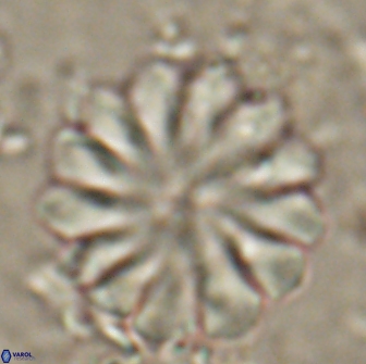 Discoaster mohleri 20805