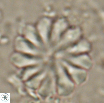 Discoaster mohleri 20805