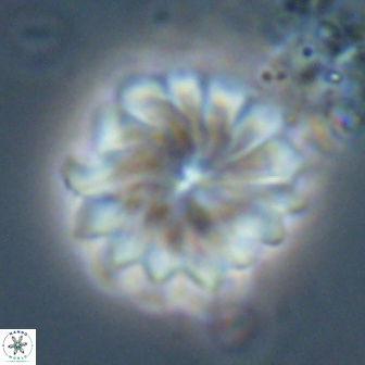 Discoaster mohleri 22380
