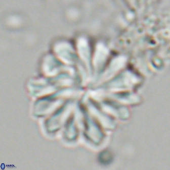 Discoaster mohleri 22381