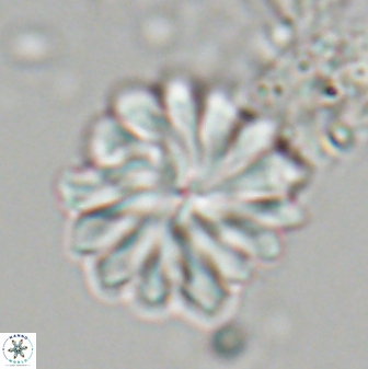 Discoaster mohleri 22381