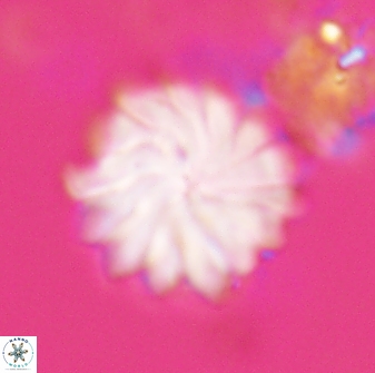 Discoaster mohleri 22383