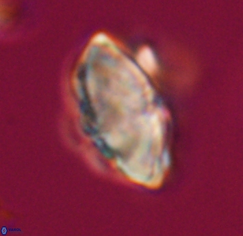 Discoaster mohleri 23570