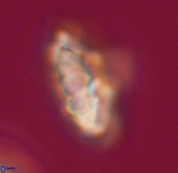 Discoaster mohleri 23572
