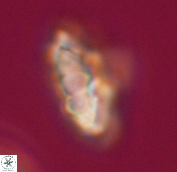 Discoaster mohleri 23572