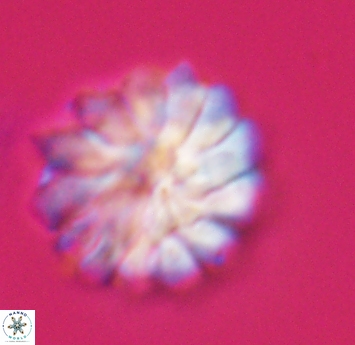 Discoaster mohleri 23575