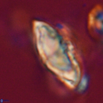 Discoaster mohleri 24193