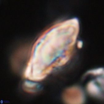 Discoaster mohleri 24197