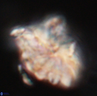 Discoaster mohleri 24201