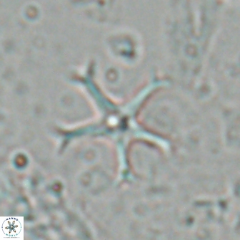 Discoaster moorei 26859
