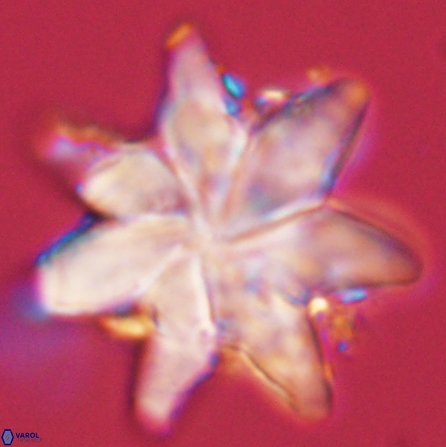 Discoaster nobilis 57246
