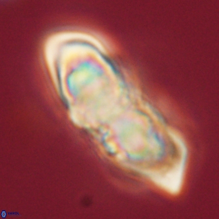 Discoaster nobilis 57247