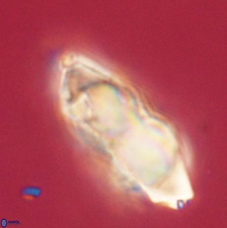 Discoaster nobilis 60493
