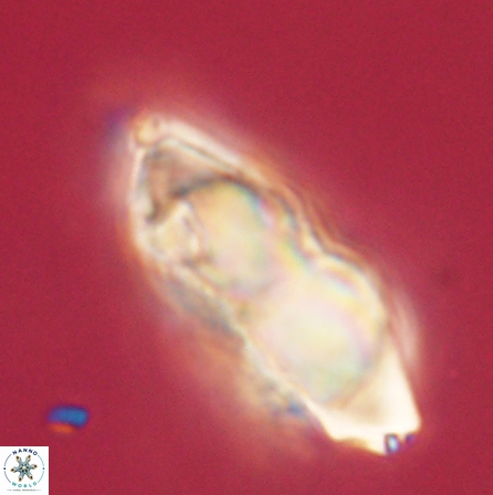 Discoaster nobilis 60493