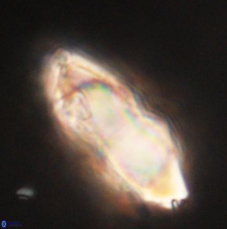 Discoaster nobilis 60494
