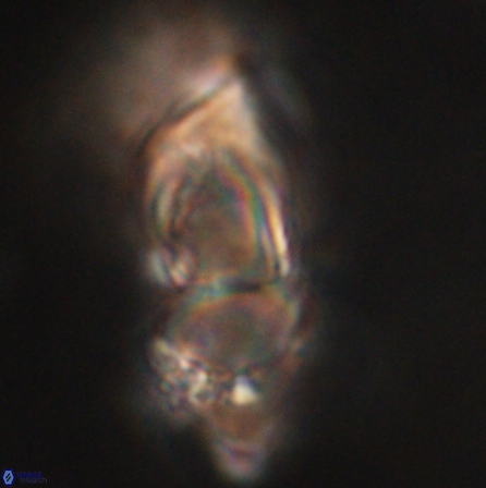 Discoaster nobilis 60495