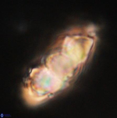 Discoaster nobilis 60499