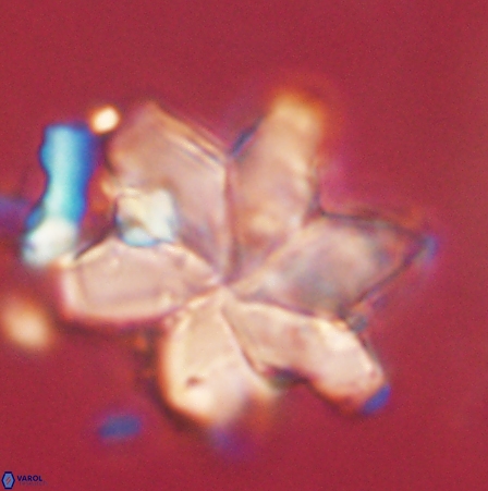 Discoaster nobilis 60509