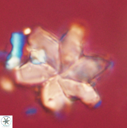 Discoaster nobilis 60509