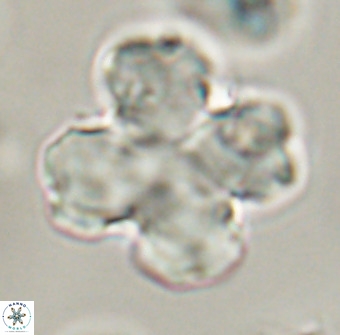 Discoaster orthogonius VR 32155