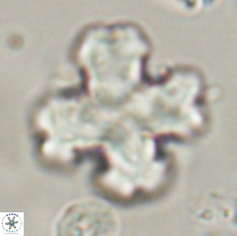 Discoaster orthogonius VR 32156