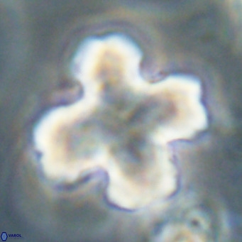 Discoaster orthogonius VR 32157