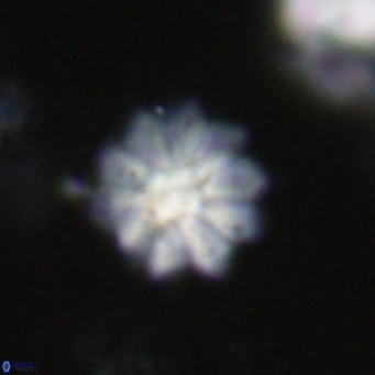 Discoaster aecus VR 30484