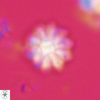 Discoaster aecus VR 30485